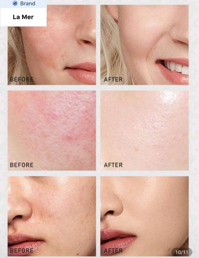 ㉓ LA MER THE TREATMENT LOTION 150ml