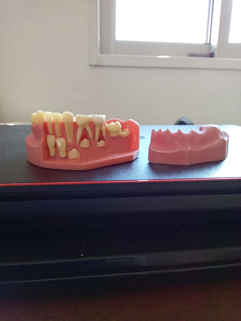 乳歯永久歯交換期模型、永久歯歯列模型