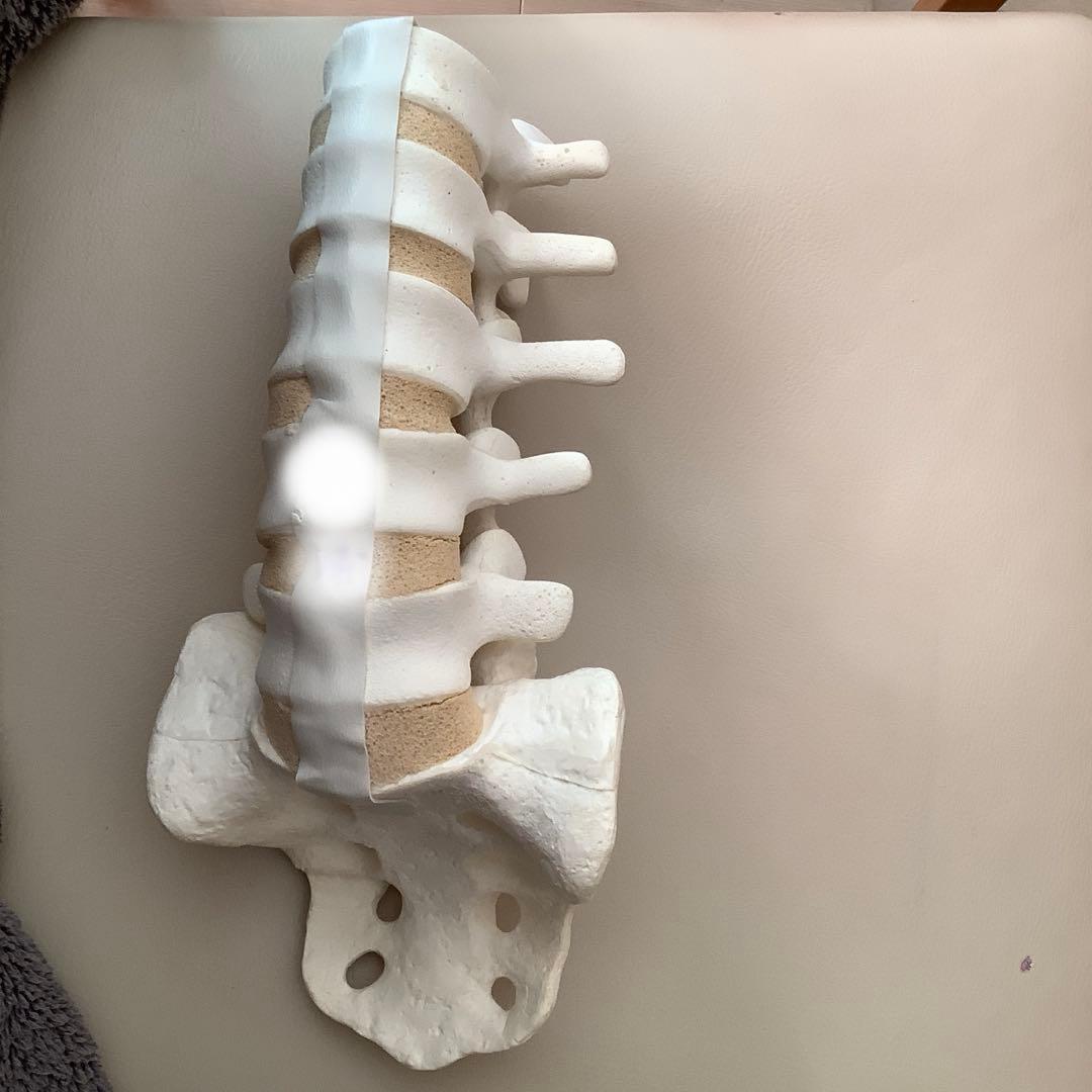 腰椎　模型