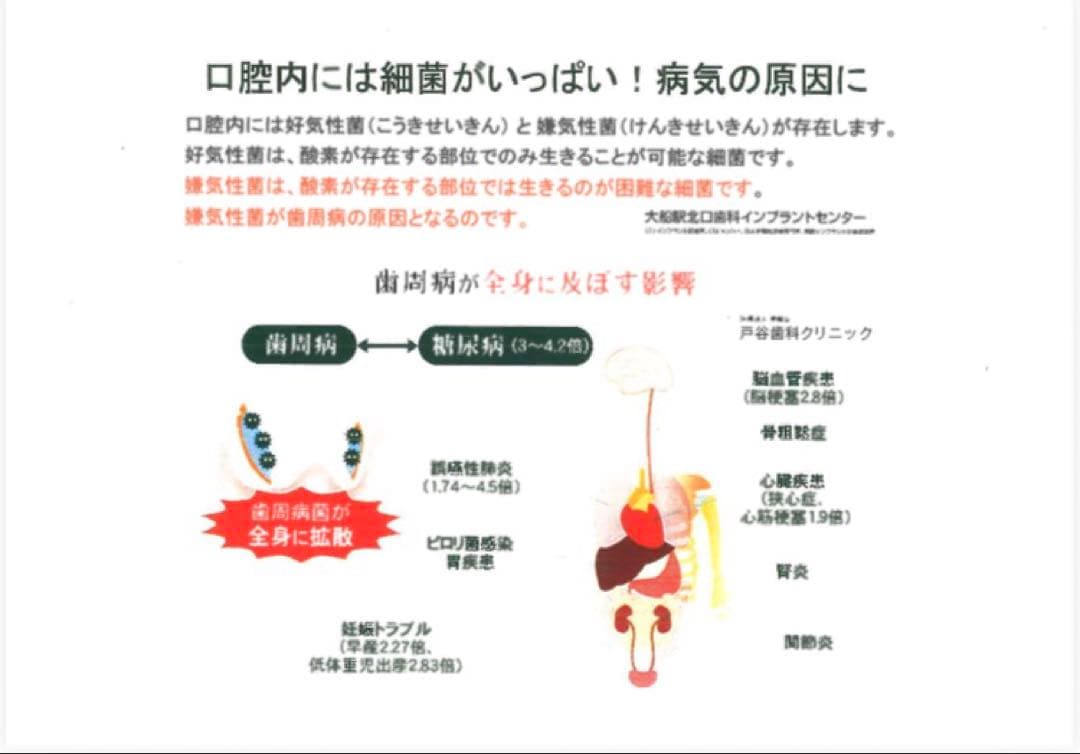 ハンディ ミスト スチーマー 酸素水150ml セット O2nanowave