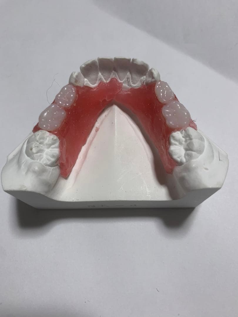 小児　入れ歯　顎模型