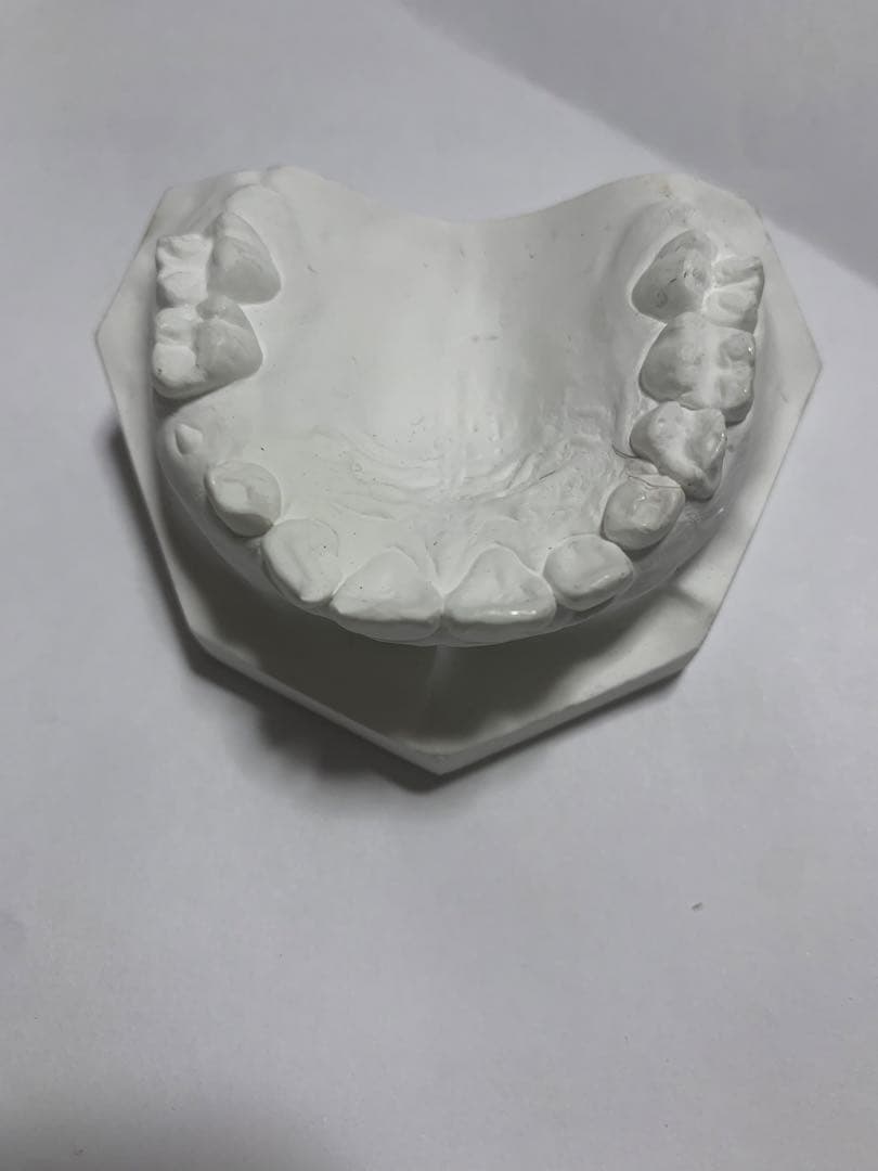 小児　入れ歯　顎模型