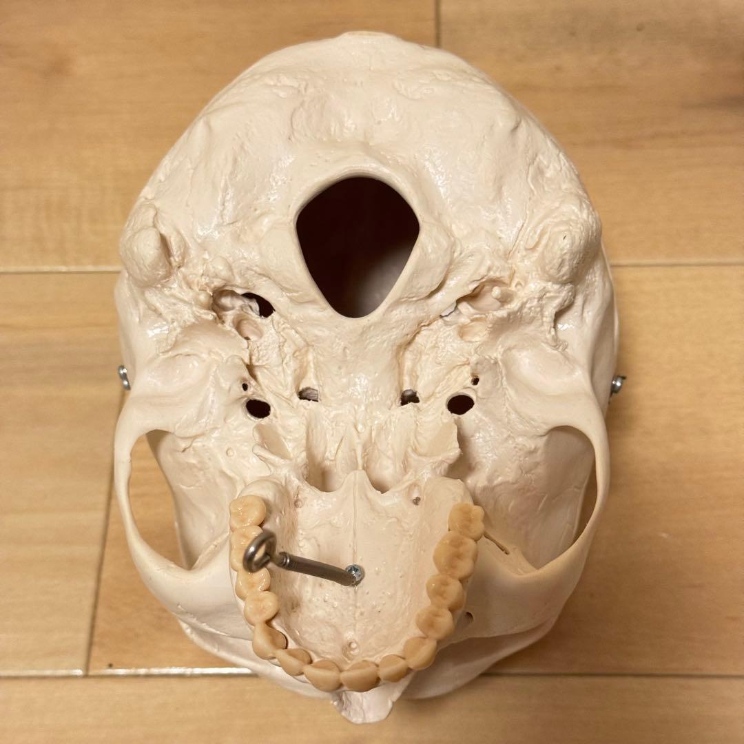 3B Scientific GmbH 頭蓋骨 模型 医学 骨標本