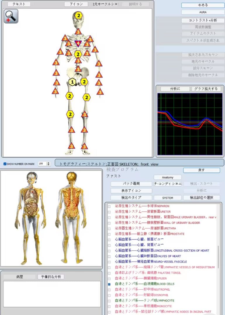 期間限定セール★波動測定器18D NLS メタトロン ニュースキャンヒーリング