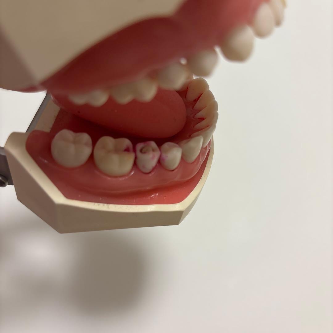 顎模型 NISSIN DENTAL MODEL