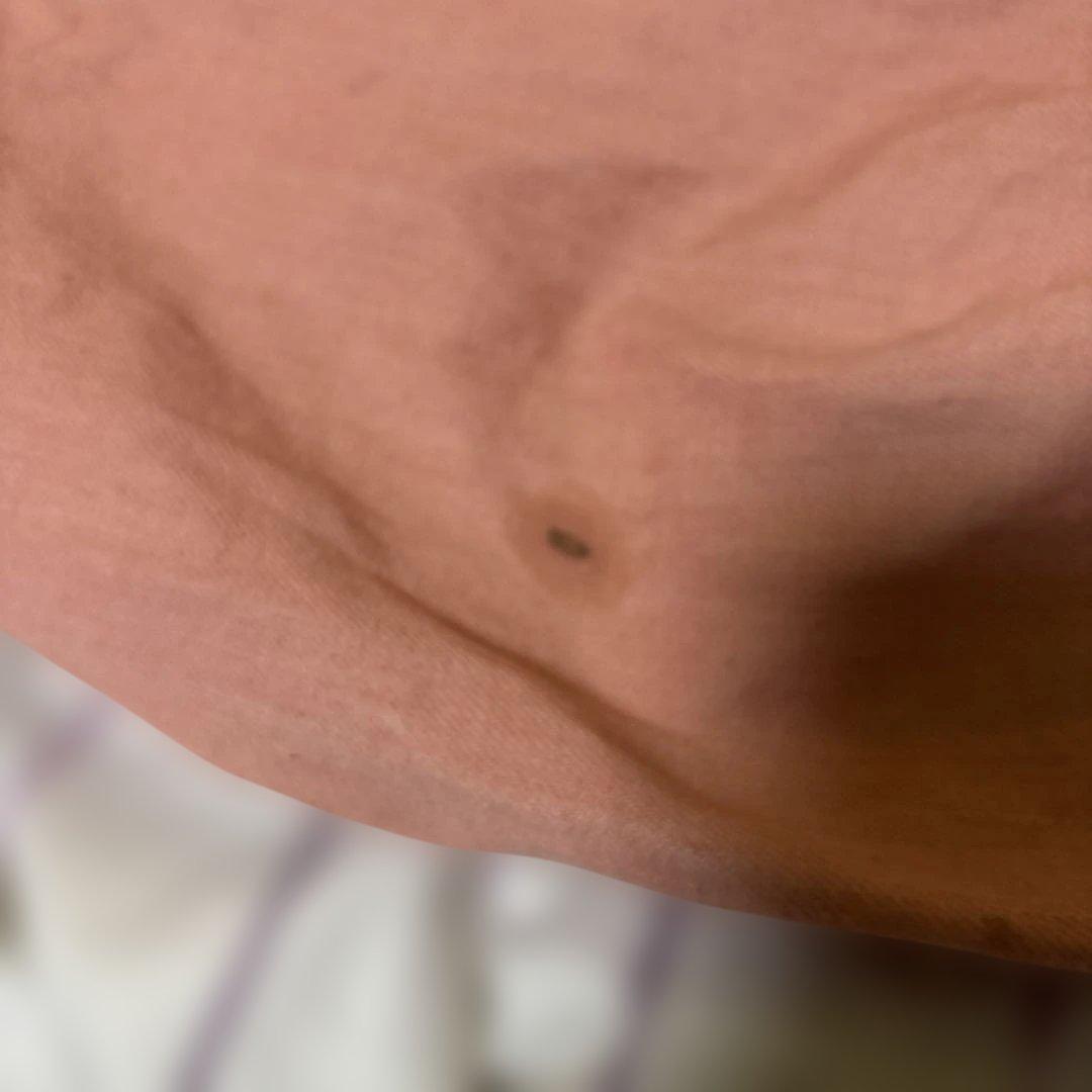 ervaスリングピンクM